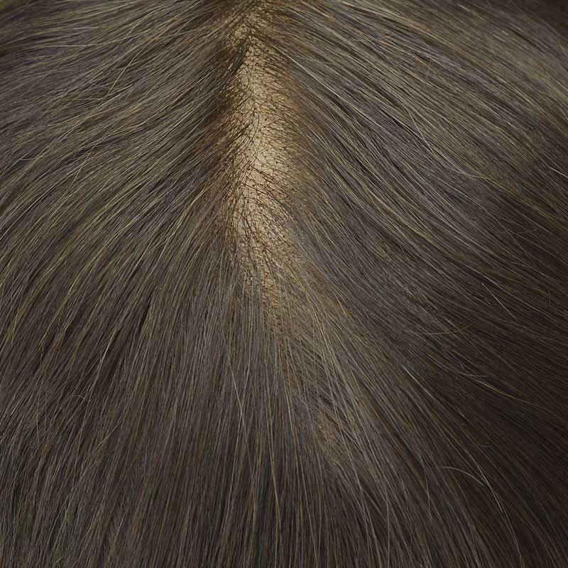 HR-SW2 Premium Swiss Lace Toupee for Men – Lightweight | Breathable | Indian Human Hair | Single Split Knots | Ideal for Sensitive Scalp & Sweaty Conditions | Non-Surgical Hair Replacement