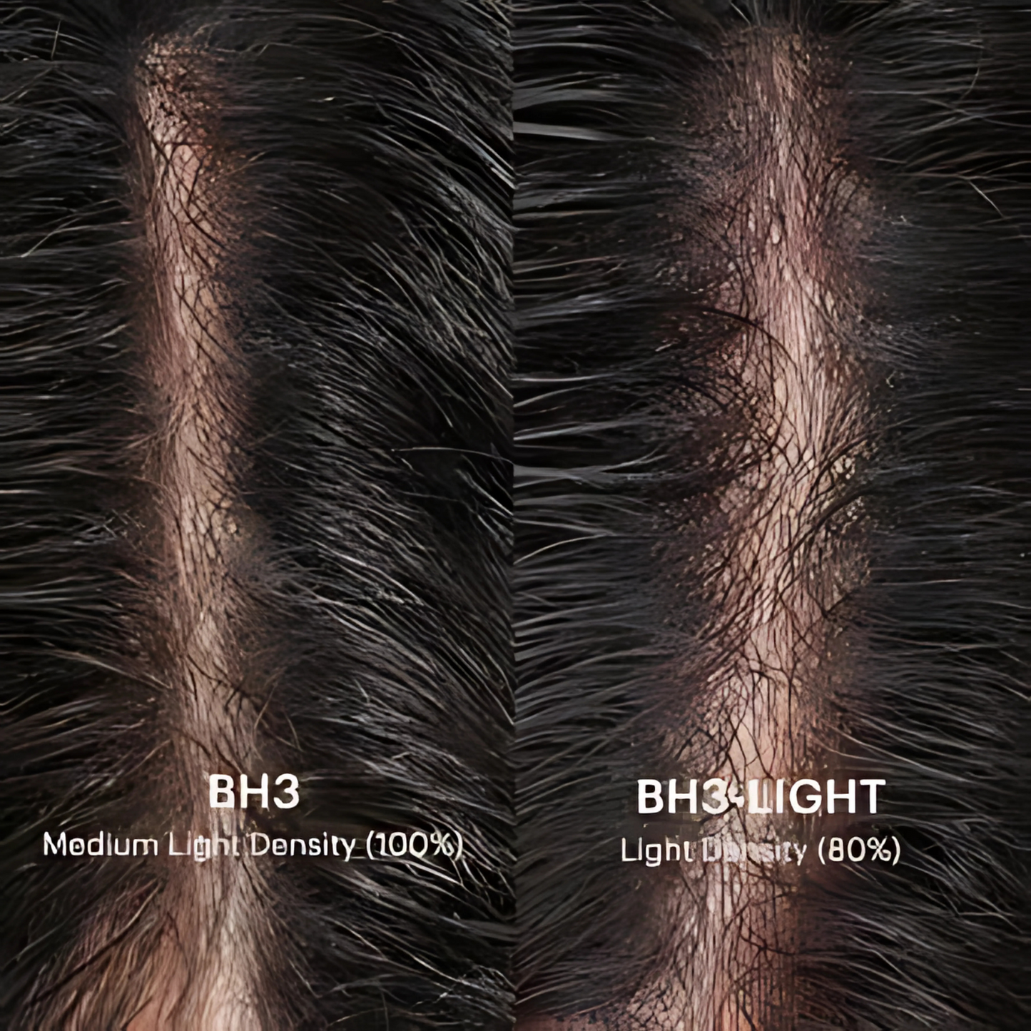 HR1 Skin Hair System for Men – 0.08mm PU Base | V-Loop Invisible Hairline + Single-Split Knots | Freestyle Natural Look | Indian Human Hair | Lightweight | Non-Surgical Hair Replacement