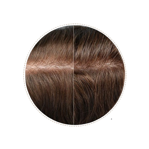 HR3 Ultra-Thin Skin Hair System for Men – 0.03 mm Thin PU Base | All-Over V-Loop Ventilation | Soft & Lightweight | Indian Human Hair | Non-Surgical Hair Replacement | Freestyle Natural Look