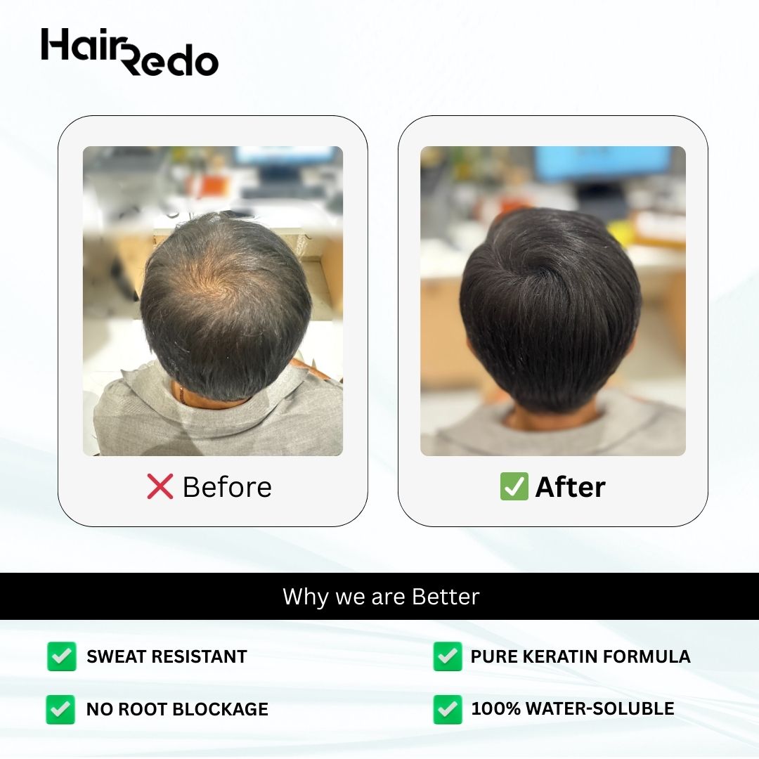 Pure Keratin Hair Fibers 11.5g Classical Pack | Instant Hair Thickening | No Root Blockage | 100% Water Soluble & Sweat Resistant