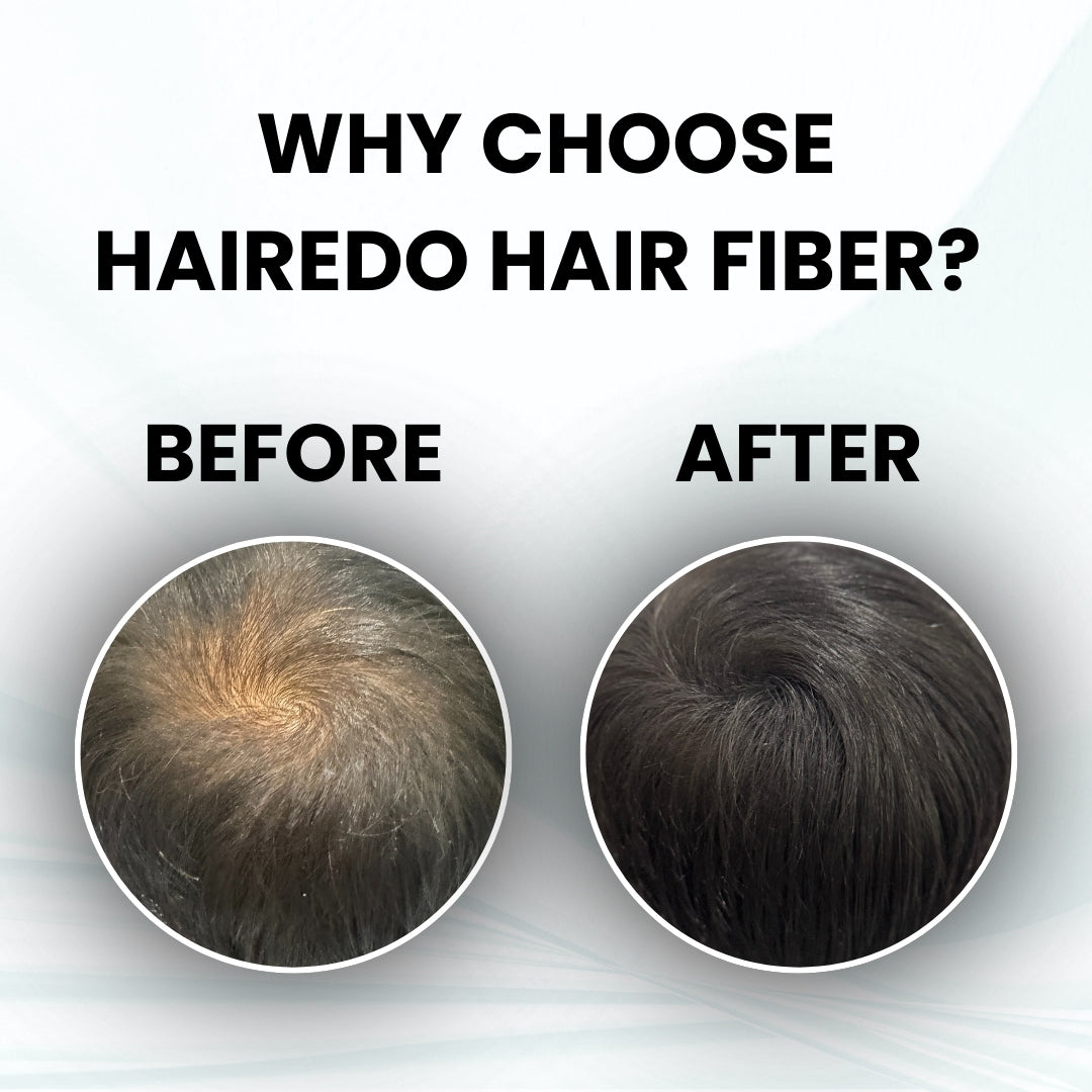 Pure Keratin Hair Fibers 11.5g Classical Pack| Instant Hair Thickening | No Root Blockage | 100% Water Soluble & Sweat Resistant