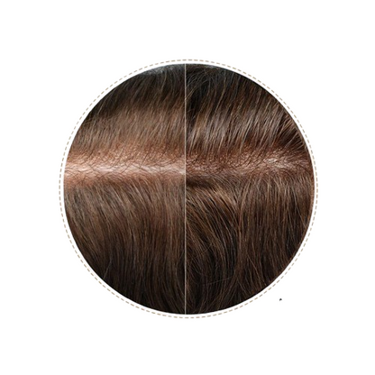 HR3 Ultra-Thin Skin Hair System for Men – 0.03 mm Thin PU Base | All-Over V-Loop Ventilation | Soft & Lightweight | Indian Human Hair | Non-Surgical Hair Replacement | Freestyle Natural Look